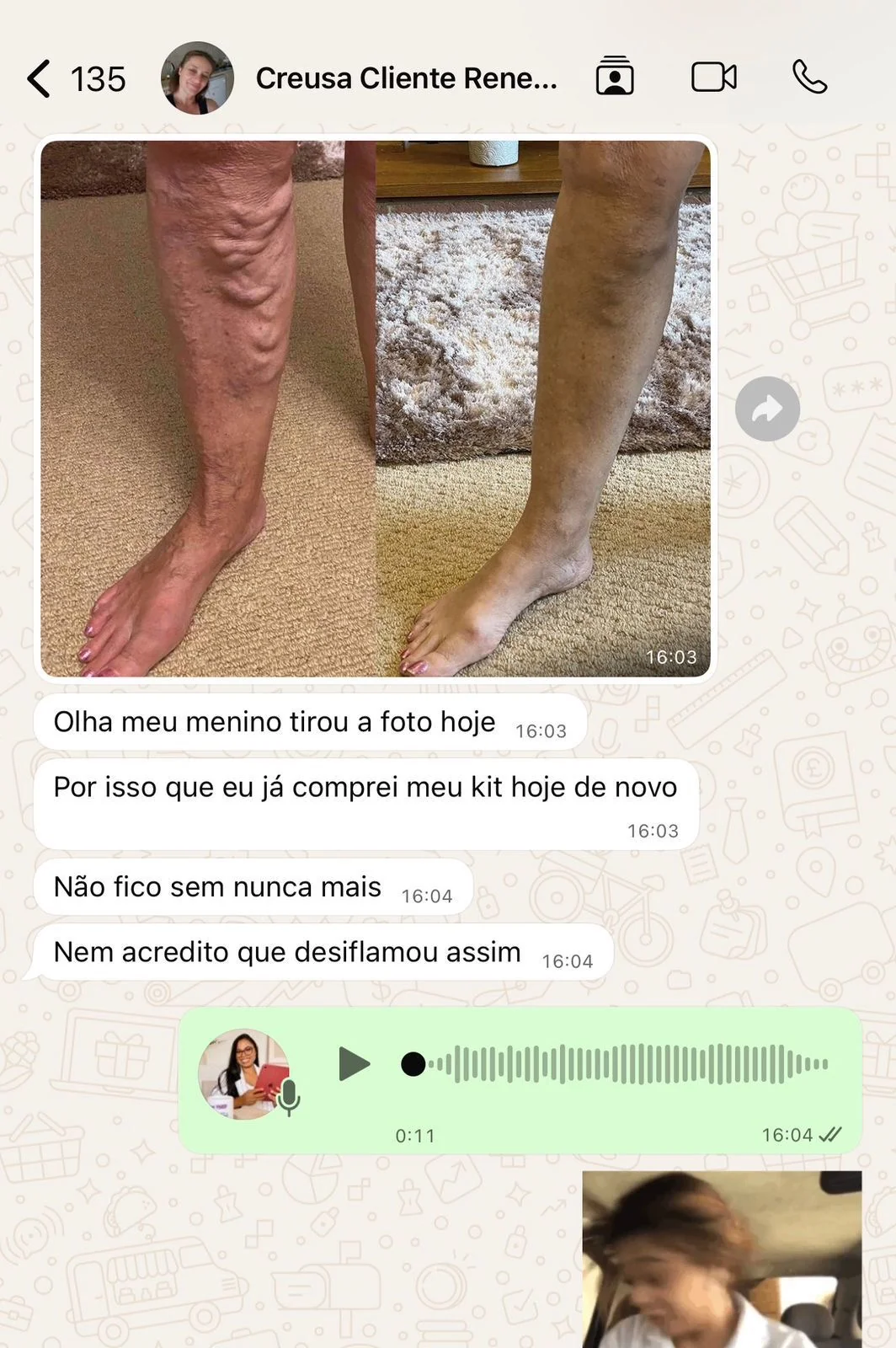 depoimento-creusa.webp?v=1792004803