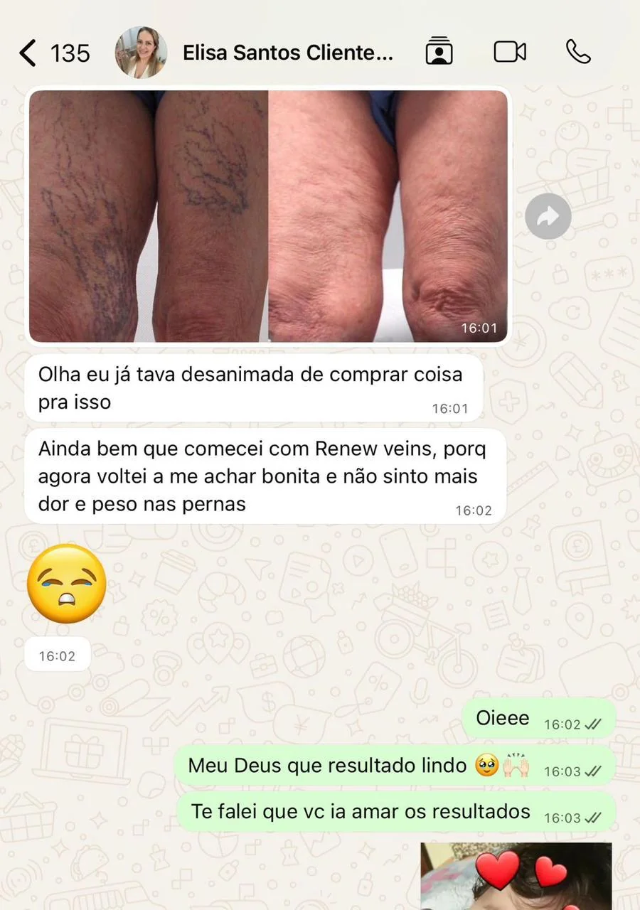 depoimento-elisa.webp?v=1792004803