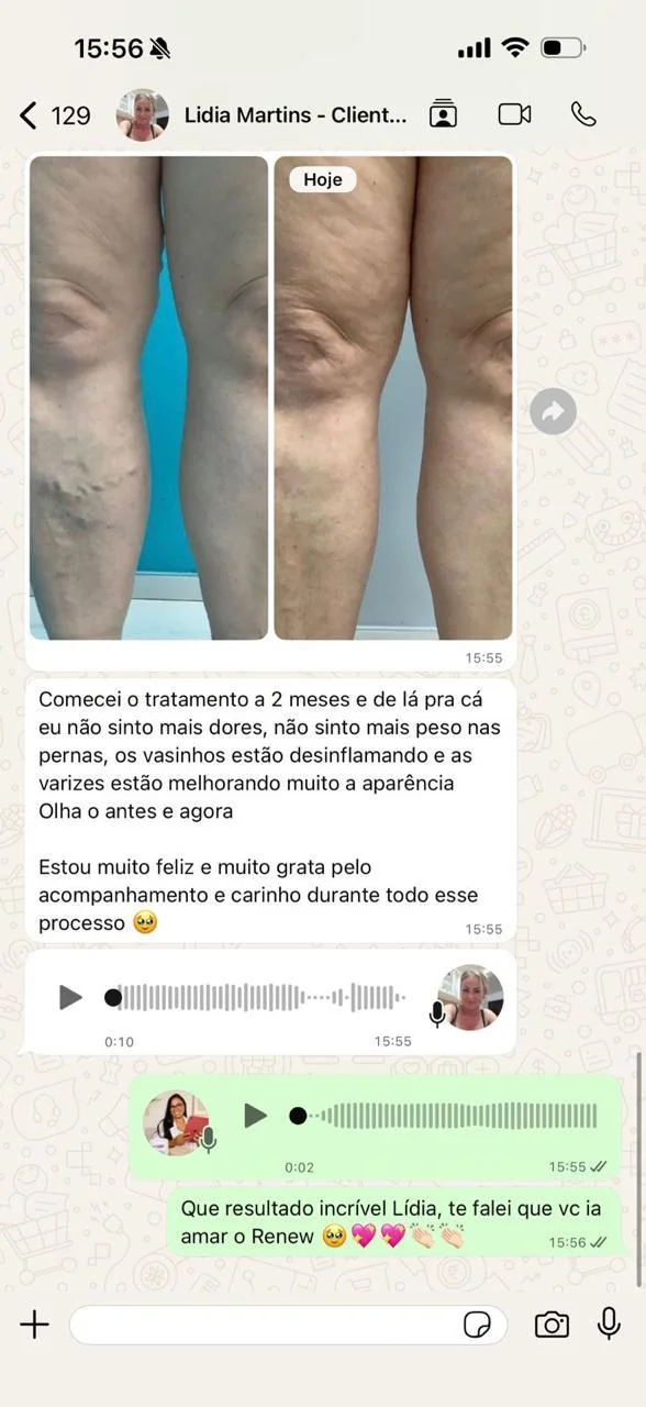 depoimento-lidia.webp?v=1792004803